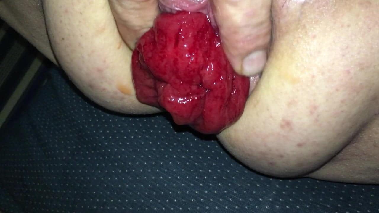 Watch This Prolapsed Asshole!