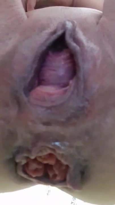 Trainning to be the biggest urethra prolapse