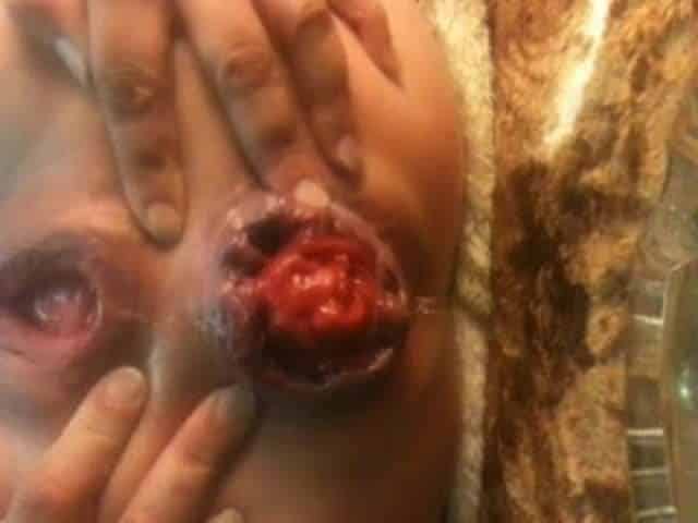 Anal rosebud training