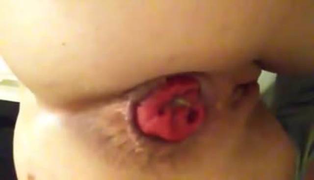 She likes her prolapse