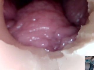 Andrada Larysa endoscope insertion