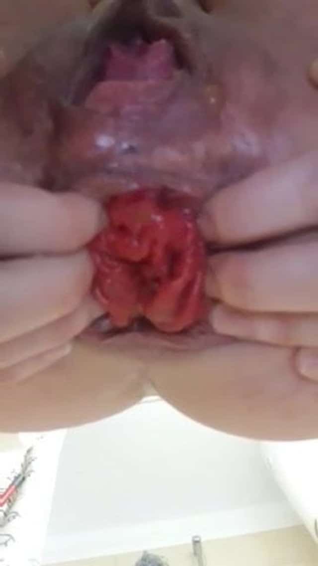 Lovely anal prolapse push