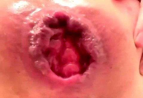 M687pro anal fisting and prolapsing