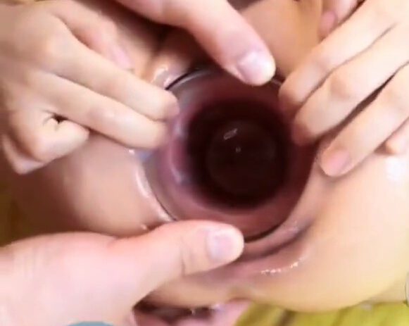 Xiu Yan Hong buries a glass in the vagina