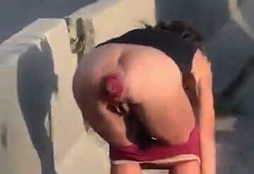 Who is she!? Mystery woman prolapsing in public! Crazy!