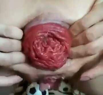 Sindy Rose prolapsing her giant asshole