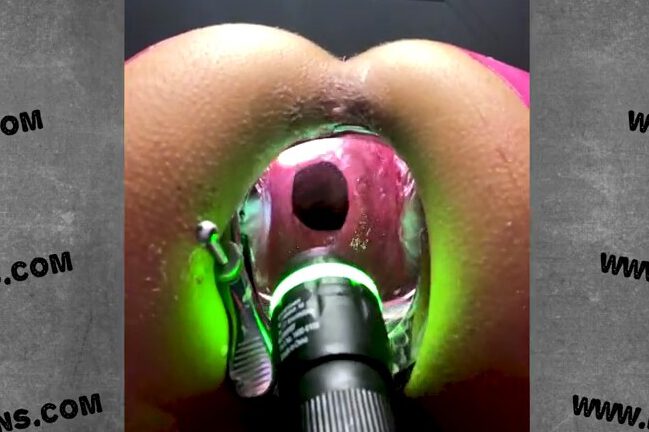 Hotkinkyjo gigantic anal cave opened by a horse speculum!