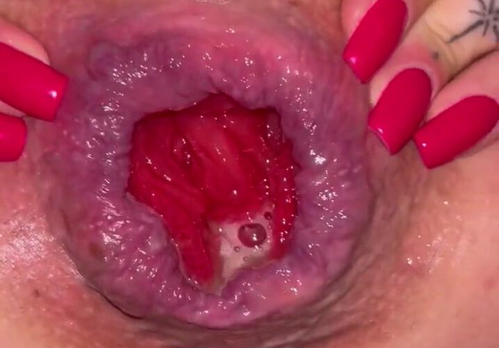 Beautiful asshole prolapse