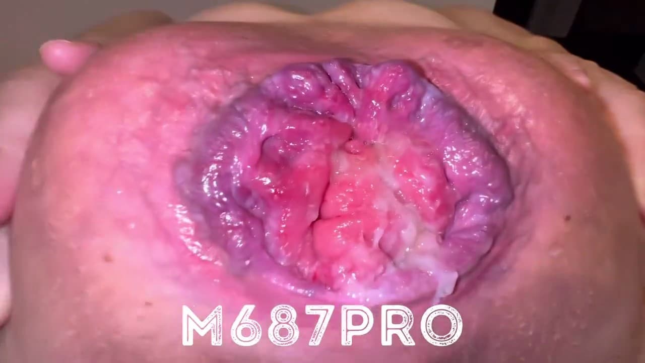 M687pro has the most destroyed asshole in the world?