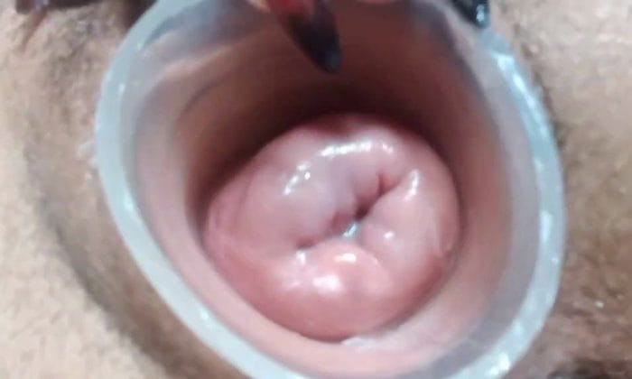 Alisson Punk showing her big cervix hole