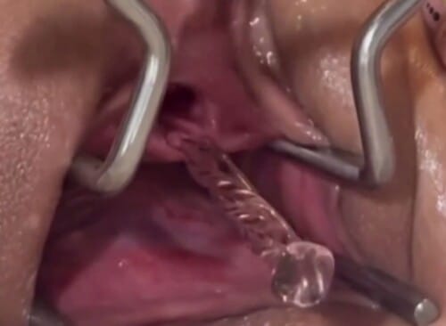 BeautyFull stretching her massive vagina with a speculum while training her urethra